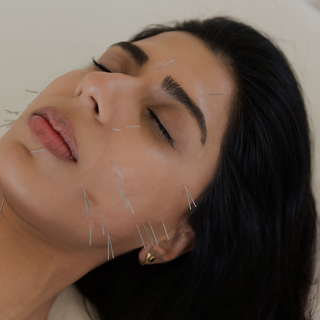 FACIAL & BODY ACUPUNCTURE: Where Beauty meets Nervous System Reset